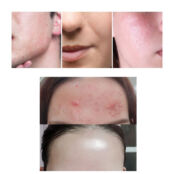 Some By Mi AHA BHA PHA 30 Days Miracle Cream 26334224 фото 4